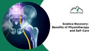 physiotherapy for sciatica calgary nw