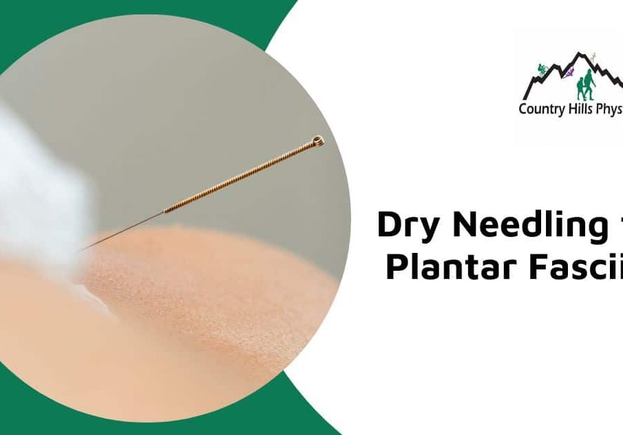 dry needling for plantar fasciitis calgary nw