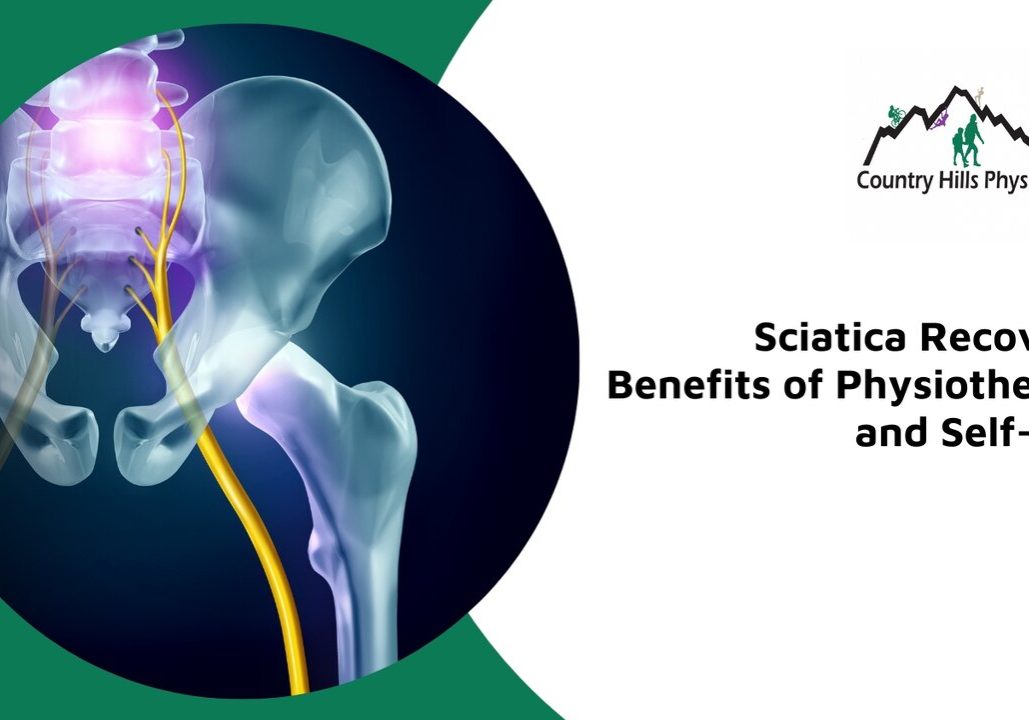 physiotherapy for sciatica calgary nw